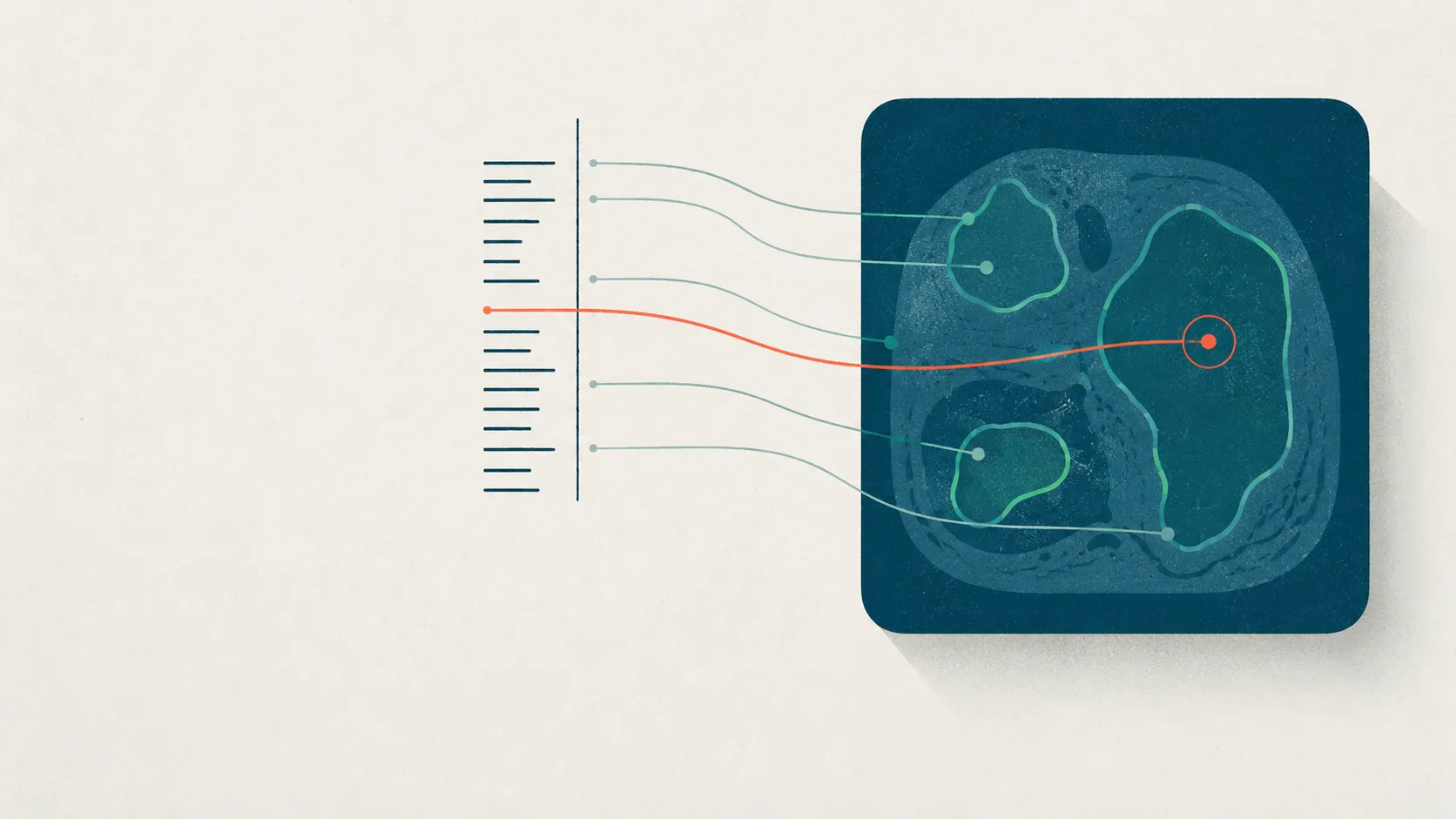 Abstract flat-vector illustration of a medical scan on the left and a column of text on the right, with a single fine coral line drawn from one phrase across to the exact region it describes on the image, and paler lines linking other phrases to other regions.